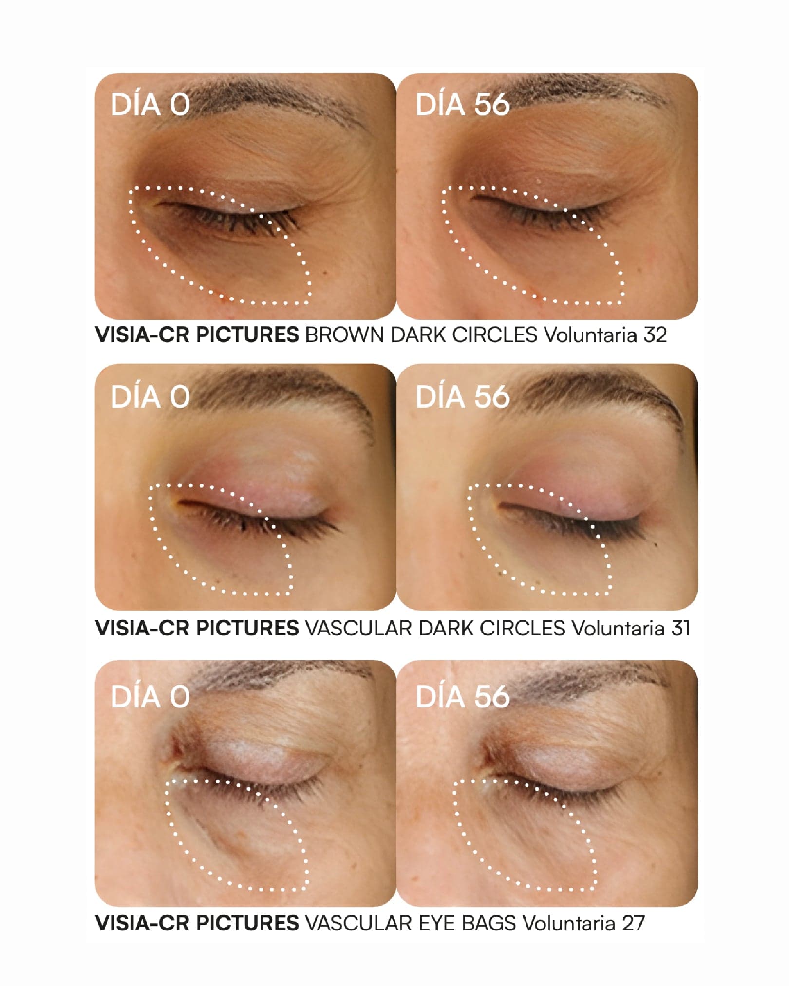 K-AT SÉRUM Contorno de ojos para ojeras y bolsas de Gema Herrerías — imagen 5