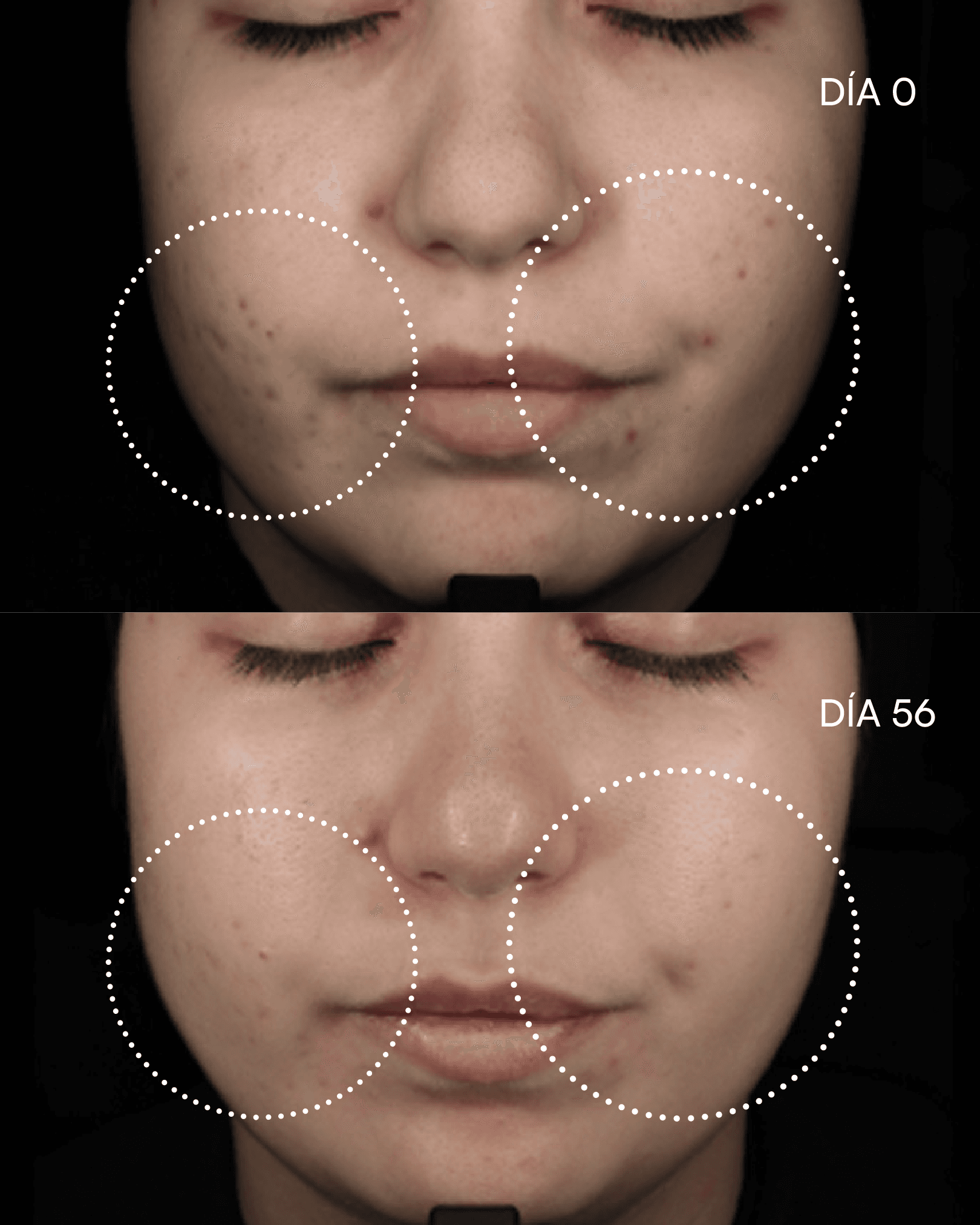 12 AZELAIC-N Sérum antioxidante imperfecciones de Gema Herrerías — imagen 5