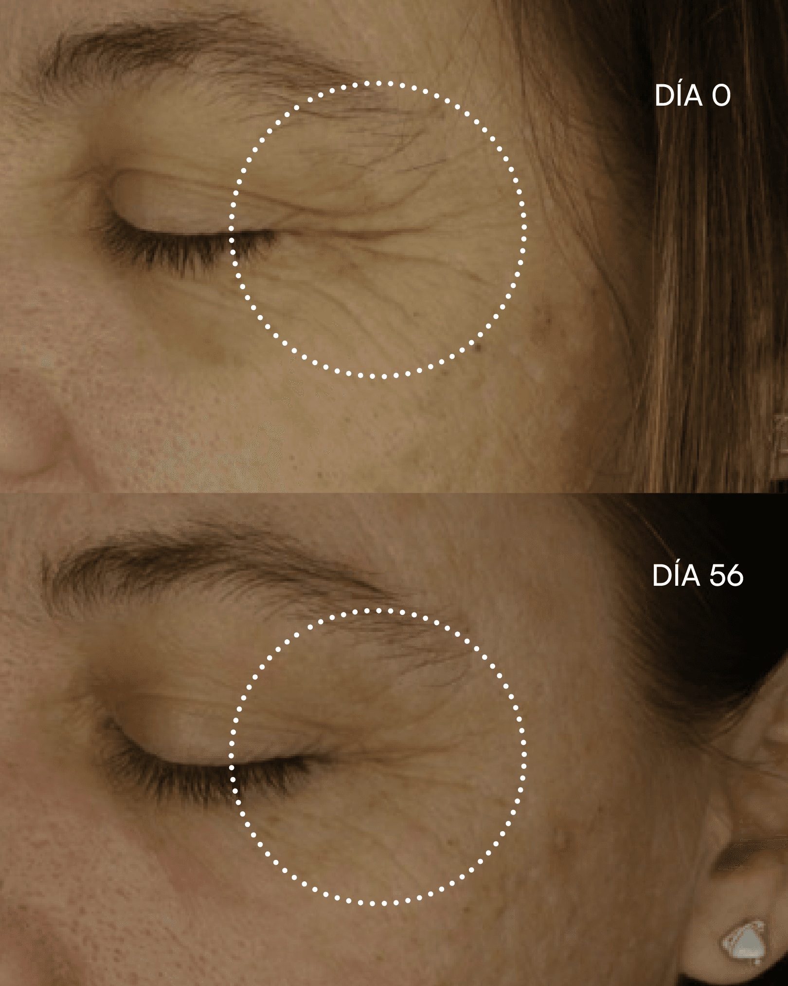 3000 RETINOL-NP Sérum antiedad arrugas y flacidez de Gema Herrerías — imagen 6